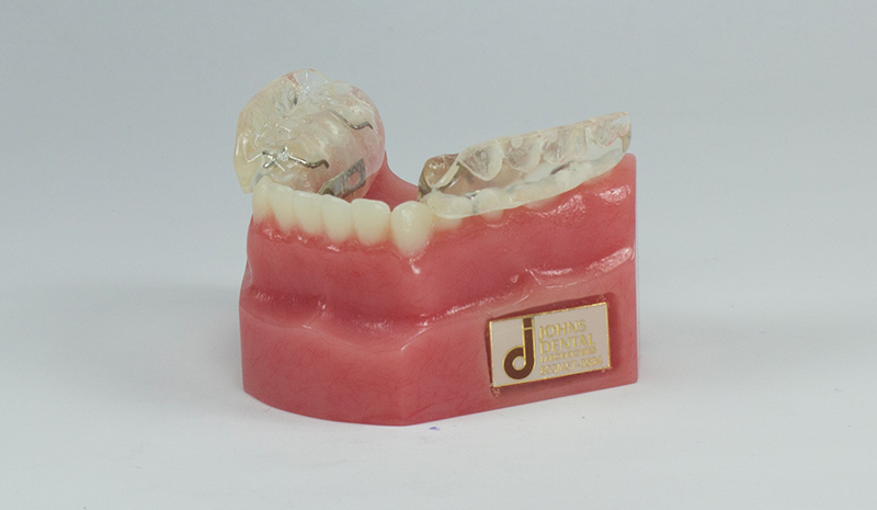 FactSplint
