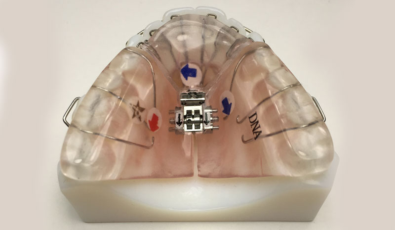 dna_ortho_upper
