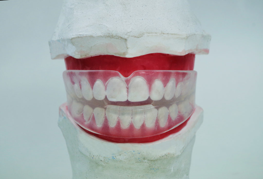 Tooth Positioner Johns Dental Lab