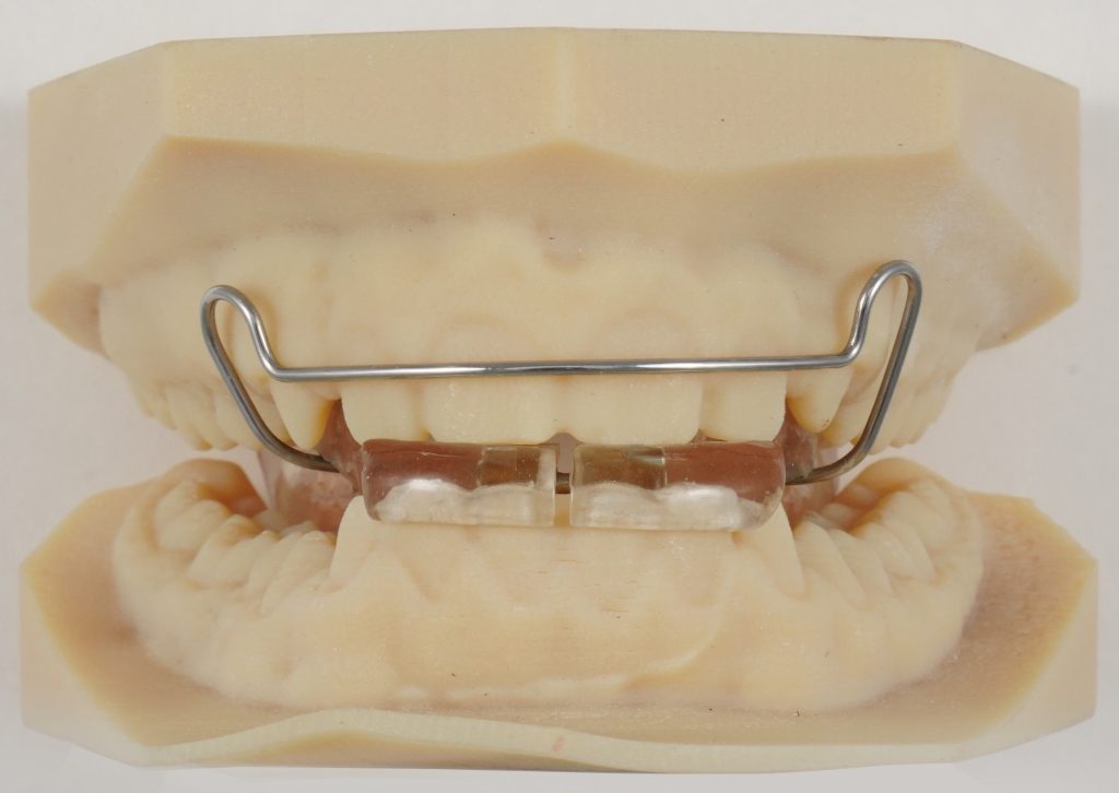 Bionator4-Front