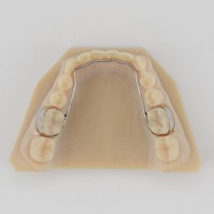 Lingual Arch 2102x2102